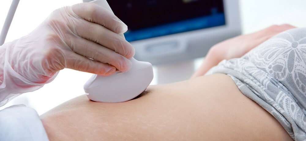 ultrasound baby scan